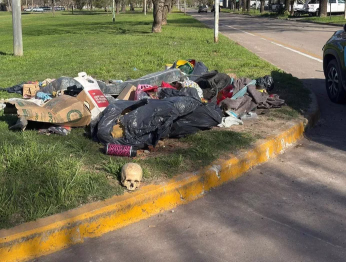 Casilda: encontraron un cráneo humano en la basura 🧠🚨
